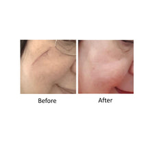 Load image into Gallery viewer, Rose Oil-Revitalize (Skin Renewing Serum)