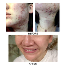 Load image into Gallery viewer, Hydrating Gel (Stablized Vitamin C Serum)
