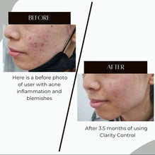 Load image into Gallery viewer, Clarity Control (Skin Lightening Cream)
